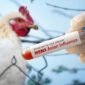 Waspada Flu Burung Naik Lagi, Jangan Lengah